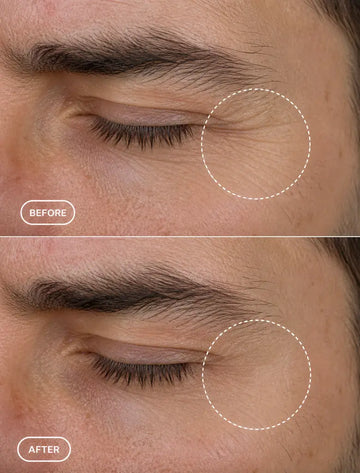 Eye Care Before and After: What Changes?